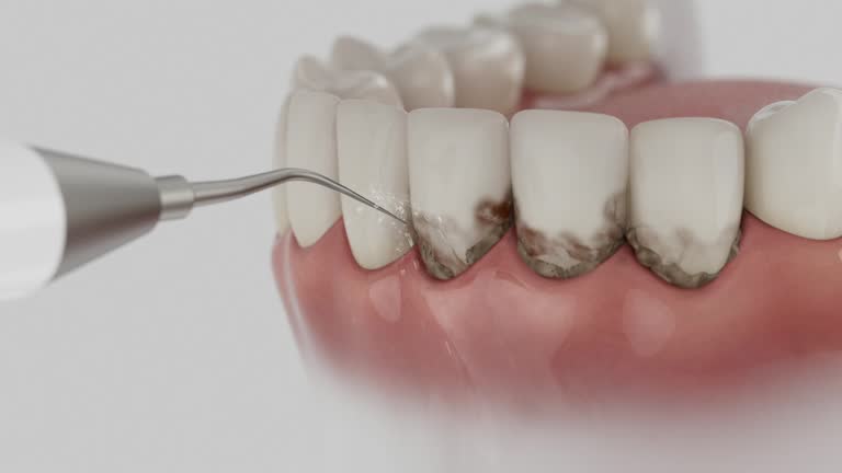 Reliable Dental contractor in Ossian, IN by Dentist Open Now